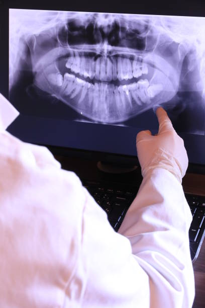 Best Urgent Tooth Repair  in Lake Cassidy, WA